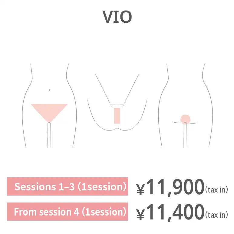 VIO. Sessions 1–3: JPY 11,900 per session (tax included) From session 4: JPY 11,400 per session (tax included)