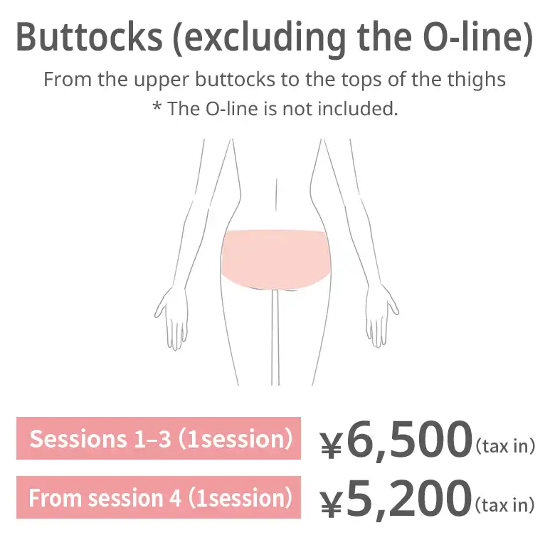 Buttocks (excluding O-line). From the top of the buttocks to the upper thighs. The O-line is excluded. Sessions 1–3: JPY 6,500 per session (tax included) From session 4: JPY 5,200 per session (tax included)