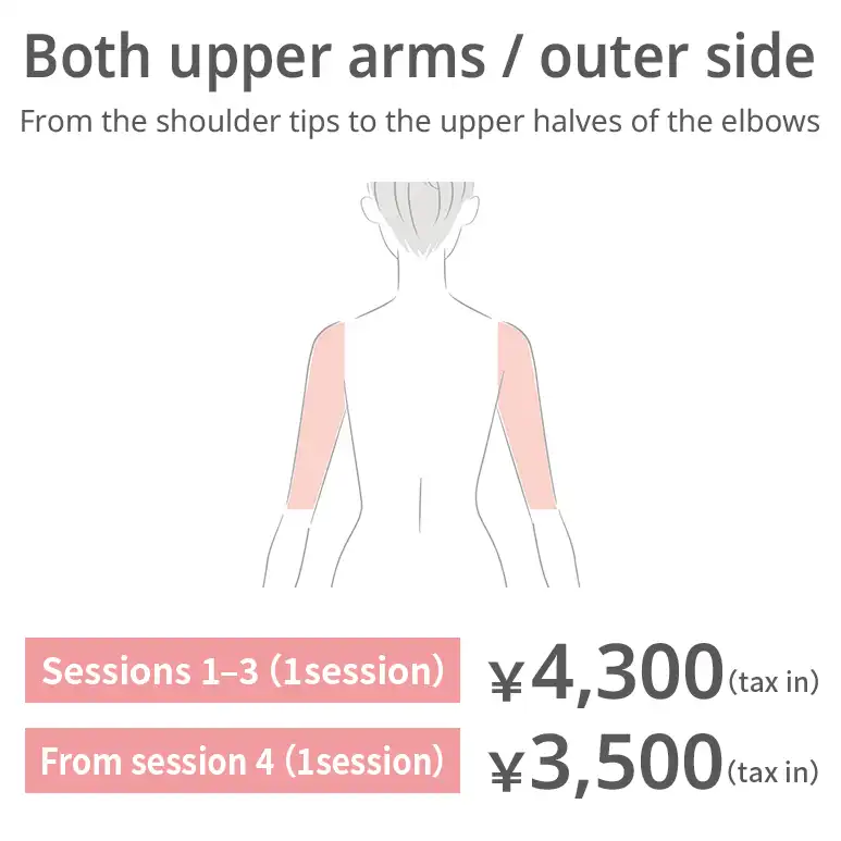 Upper arms — outer side. From the shoulder tips to the upper half of the elbows. Sessions 1–3: JPY 4,300 per session (tax included) From session 4: JPY 3,500 per session (tax included)