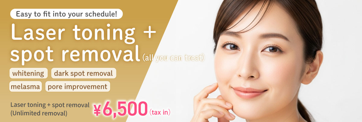 Laser toning