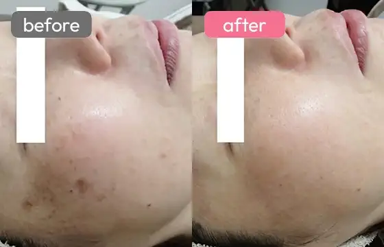 Before / After