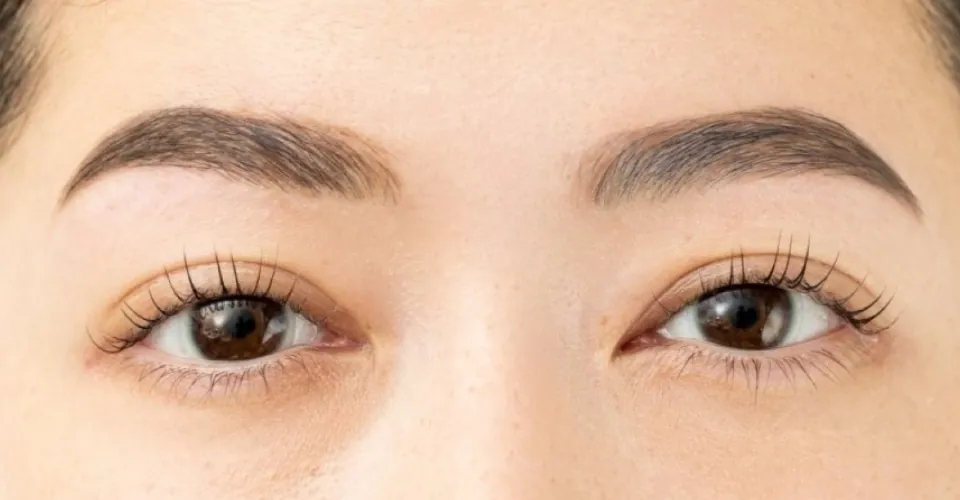 日本人の繊細で敏感なお肌に合わせた施術工程 AFTER