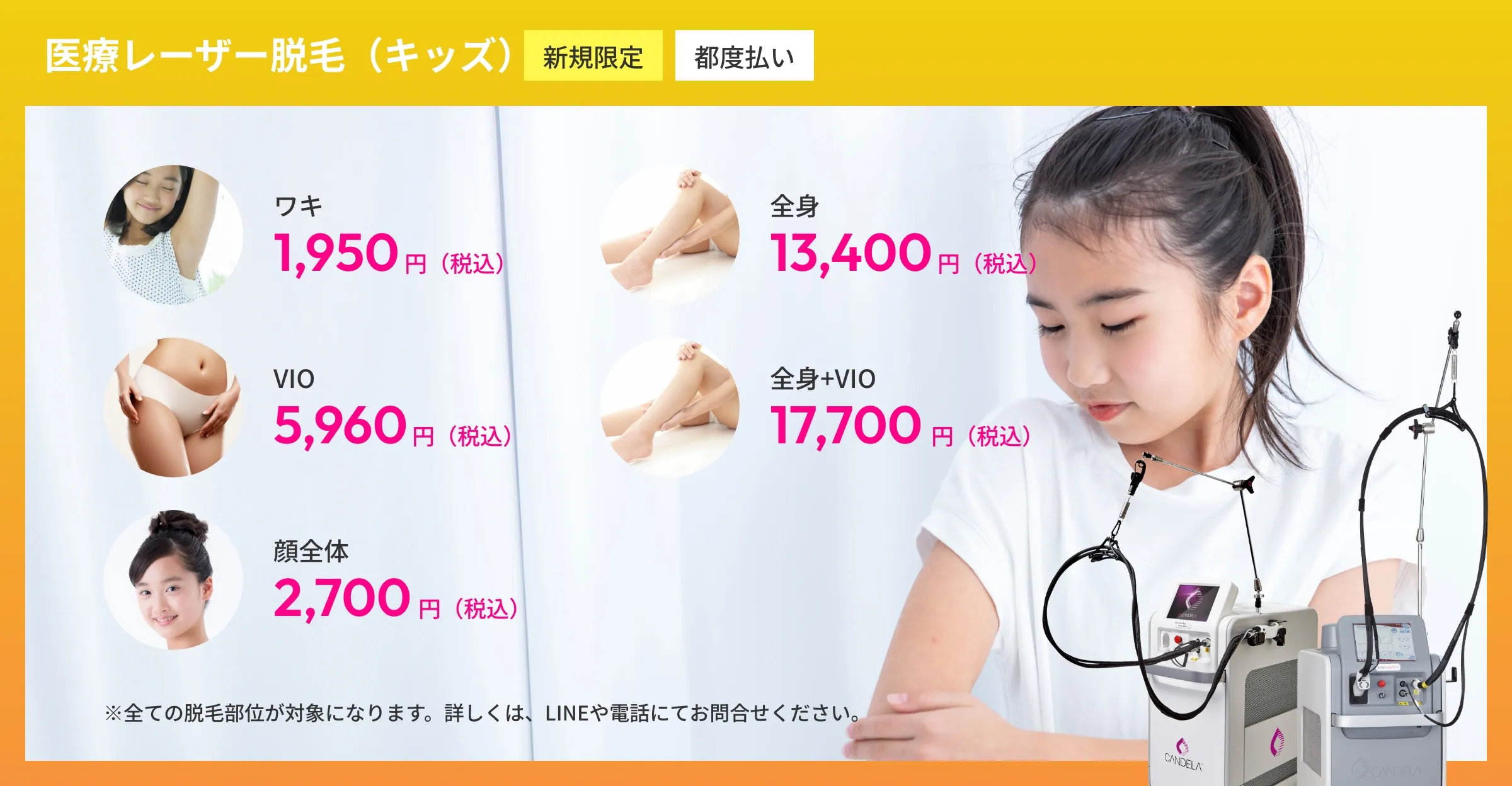 医療レーザー脱毛（キッズ）