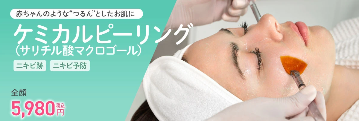 ケミカルピーリング（サリチル酸マクロゴール）