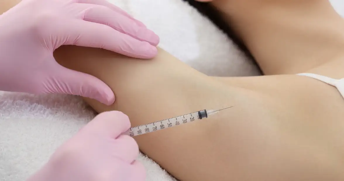 ボトックス注射で汗止め！不快感解消に治療が有効