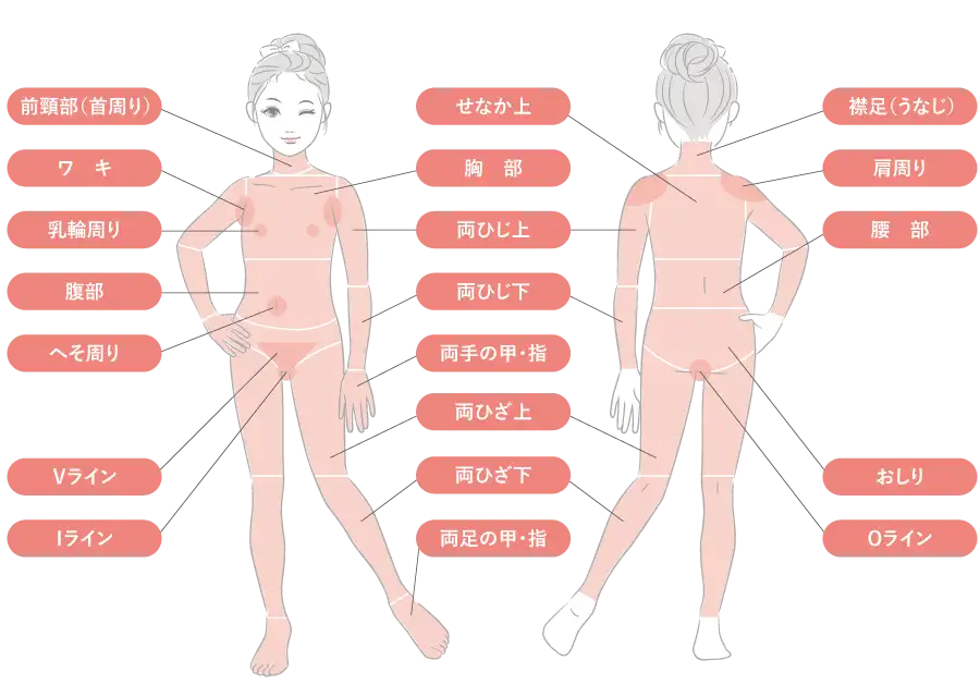医療脱毛(照射部位)