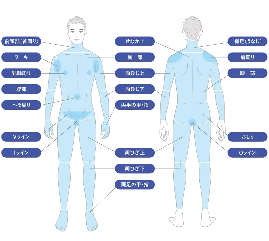 医療脱毛(照射部位)