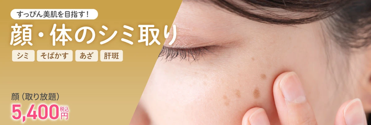顔・体のシミ取り