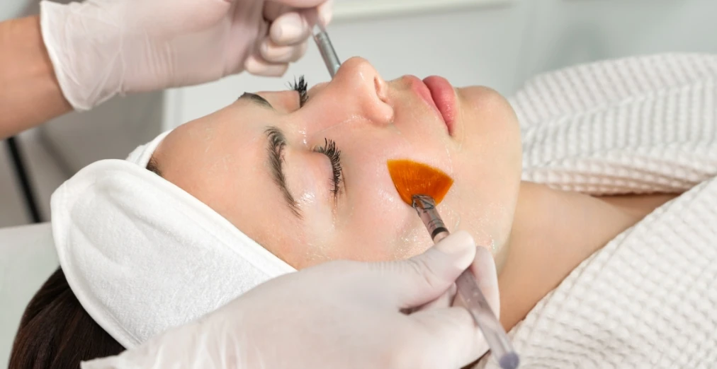 ケミカルピーリング（サリチル酸マクロゴール）