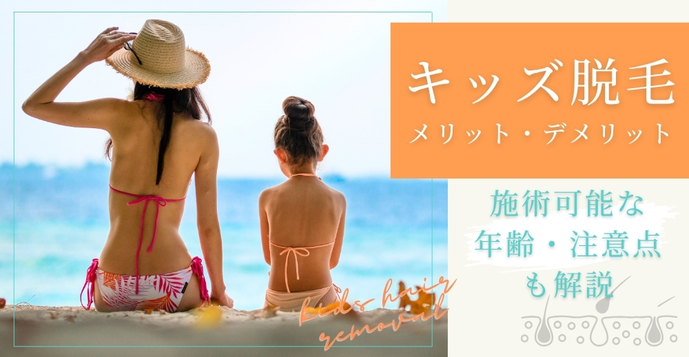 キッズ脱毛のメリット・デメリット｜施術可能な年齢・注意点も解説