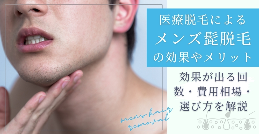 医療脱毛によるメンズ髭脱毛の効果やメリット｜効果が出る回数・費用相場・選び方を解説