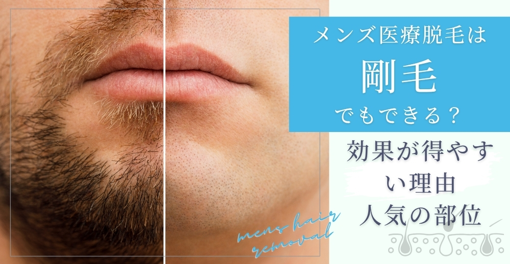 メンズ医療脱毛は剛毛でもできる？効果が得やすい理由・人気の部位・注意点を解説