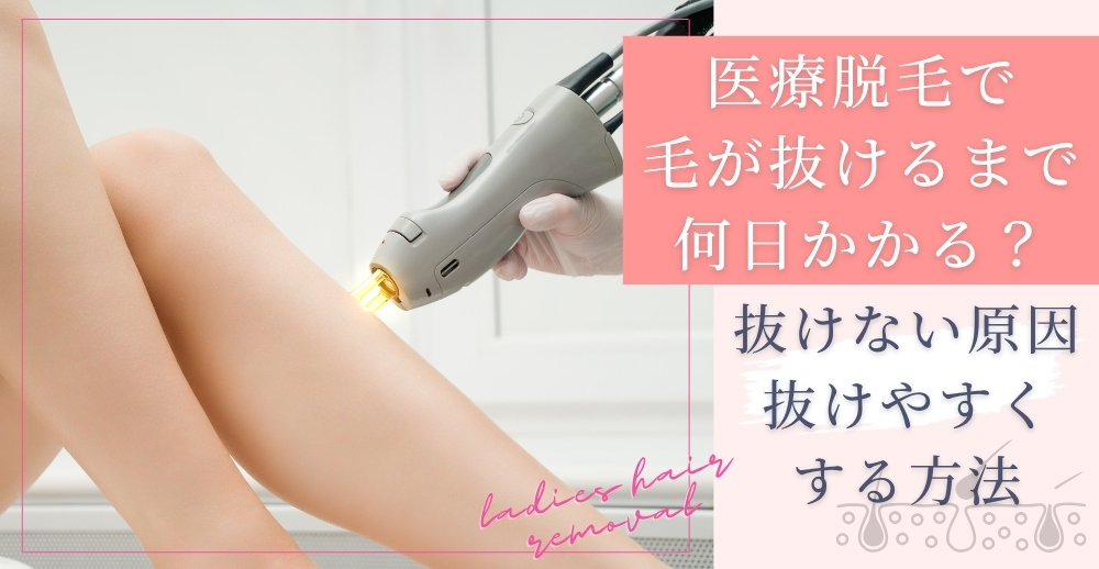 医療脱毛で毛が抜けるまで何日かかる？抜けない原因・抜けやすくする方法なども解説
