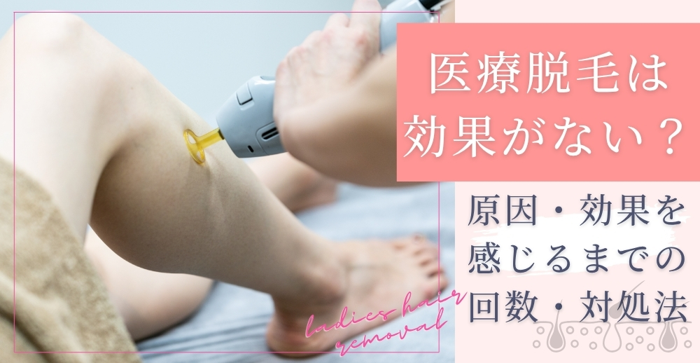 医療脱毛は効果がない？原因・効果を感じるまでの回数・対処法などを解説