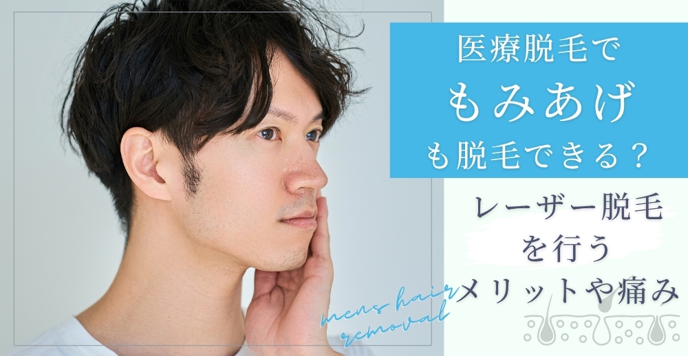 医療脱毛でもみあげも脱毛できる？レーザー脱毛を行うメリットや痛みについて解説