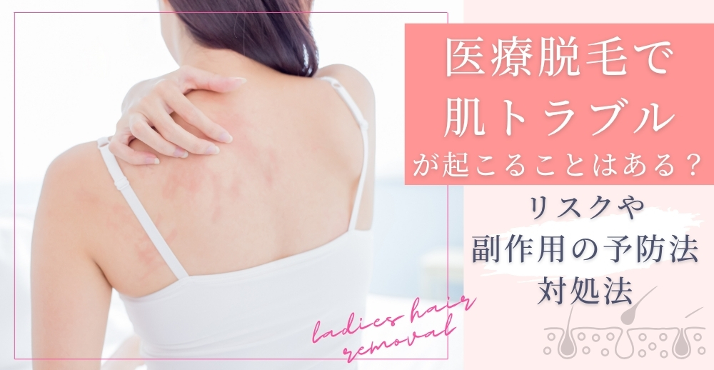 医療脱毛で肌トラブルが起こることはある？リスクや副作用の予防法・対処法を解説