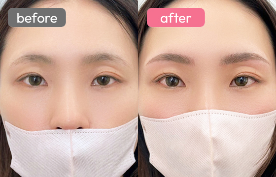 眉アートメイク-015