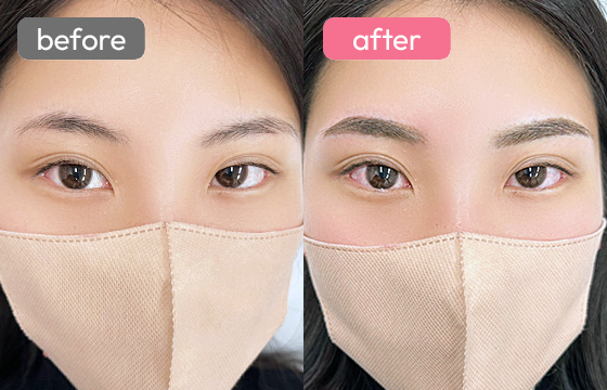 眉アートメイク-019 03