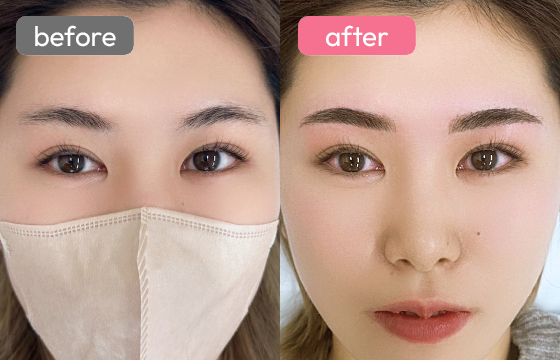 眉アートメイク-023 02