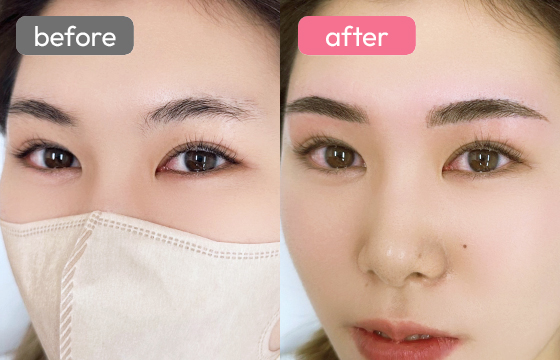 眉アートメイク-023 03