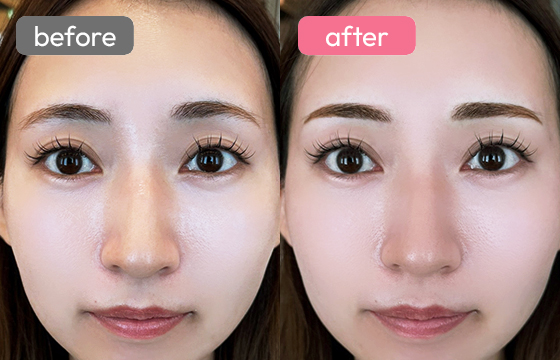 眉アートメイク-025 02