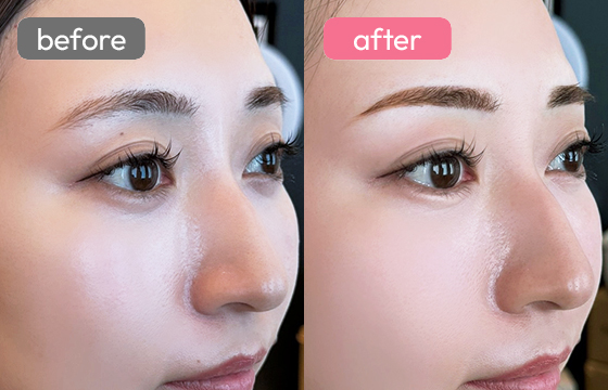 眉アートメイク-025