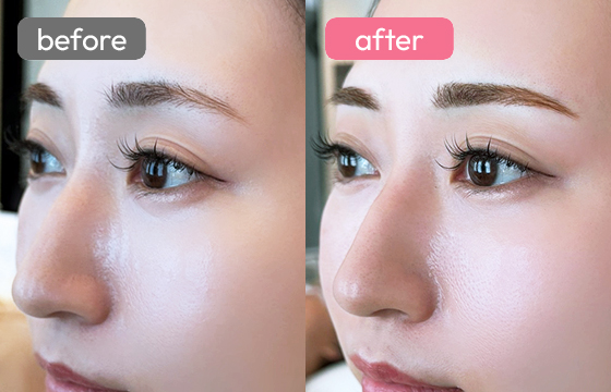 眉アートメイク-025 03