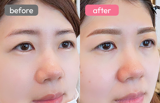 眉アートメイク-027