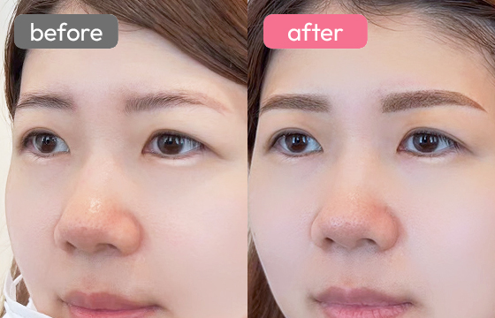 眉アートメイク-027 02