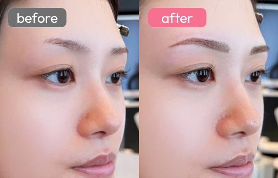 眉アートメイク-032 02