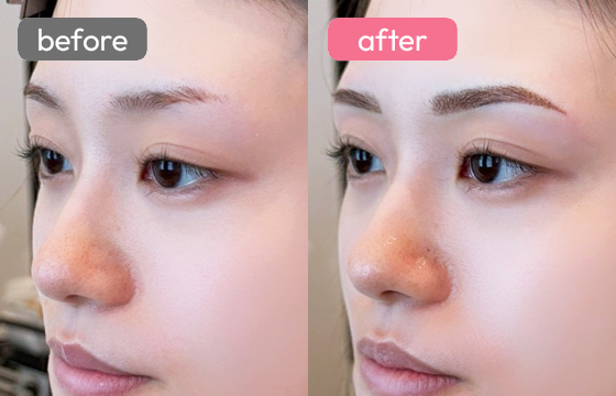 眉アートメイク-032