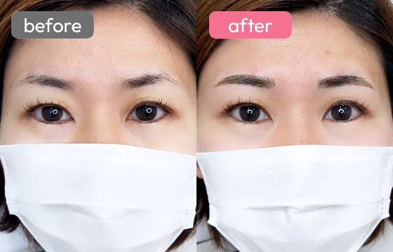 眉アートメイク-078