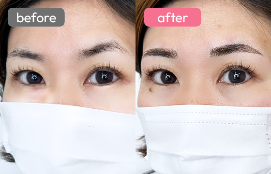 眉アートメイク-078 02