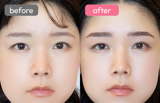 眉アートメイク-033 02