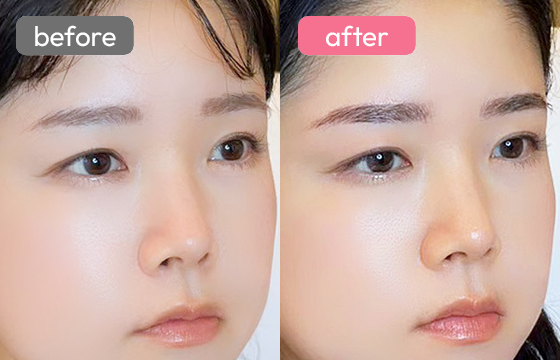 眉アートメイク-033 03