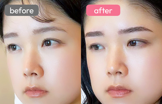 眉アートメイク-033 04