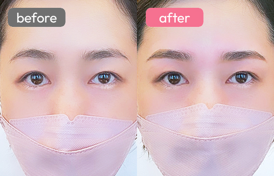 眉アートメイク-034