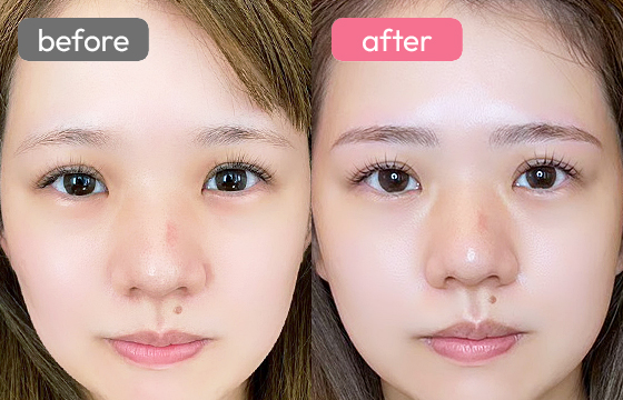 眉アートメイク-081 02