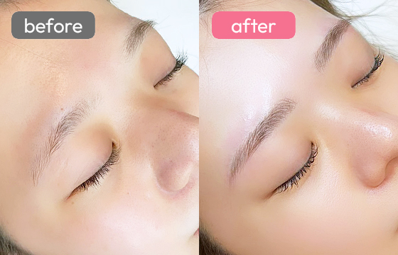 眉アートメイク-081