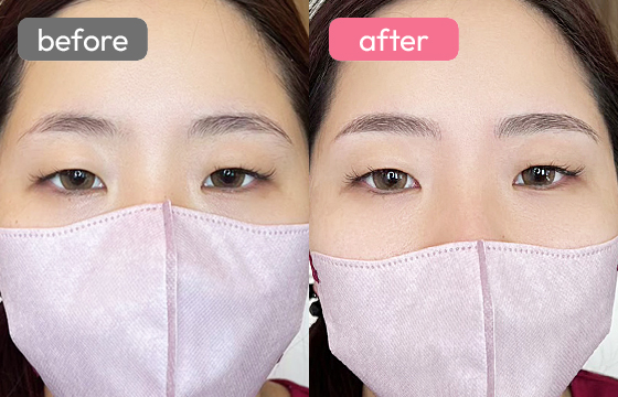 眉アートメイク-080 02