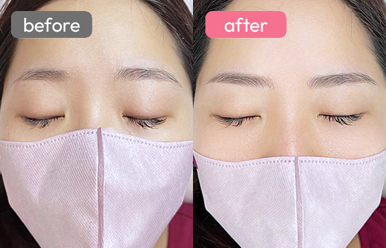 眉アートメイク-080 03