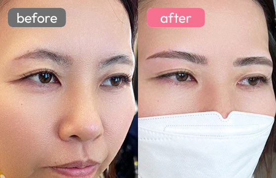 眉アートメイク-038 03