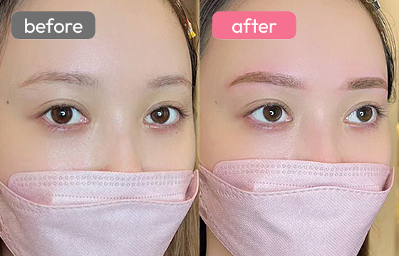 眉アートメイク-039 03