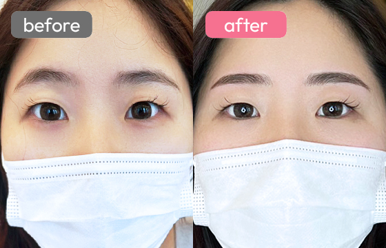 眉アートメイク-040