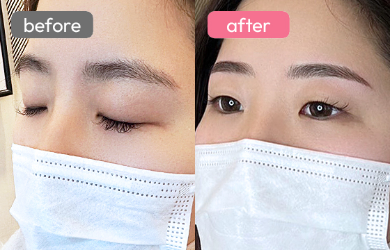 眉アートメイク-041 03