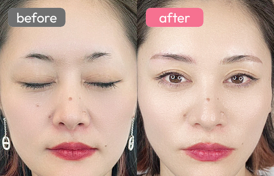 眉アートメイク-042