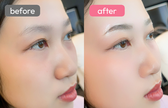 眉アートメイク-044 02