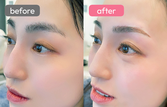 眉アートメイク-045