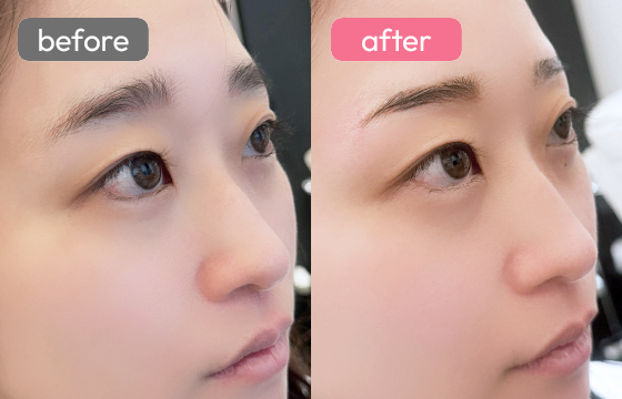 眉アートメイク-083