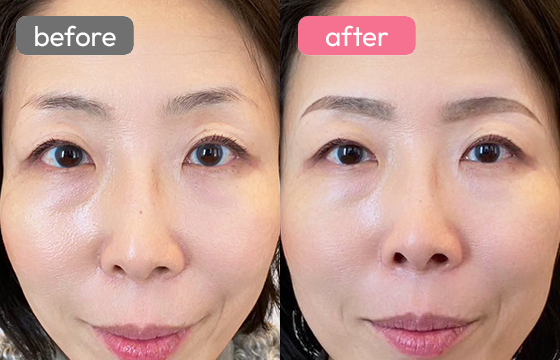 眉アートメイク-046 02